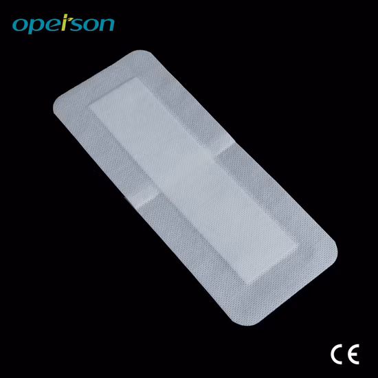 外科用医療用接着剤 使い捨て 非